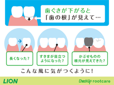 Check-Up rootcare_イメージ2
