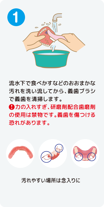 [STEP1]流水下で食べかすなどのおおまかな汚れを洗い流してから、義歯ブラシで義歯を清掃します。！力の入れすぎ、研磨剤配合歯磨剤の使用は禁物です。義歯を傷つける恐れがあります。汚れやすい場所は念入りに