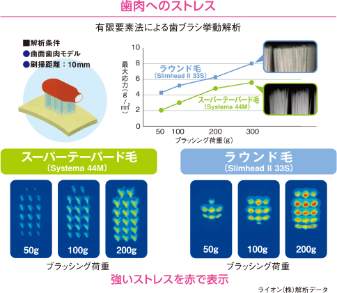 歯肉へのストレス