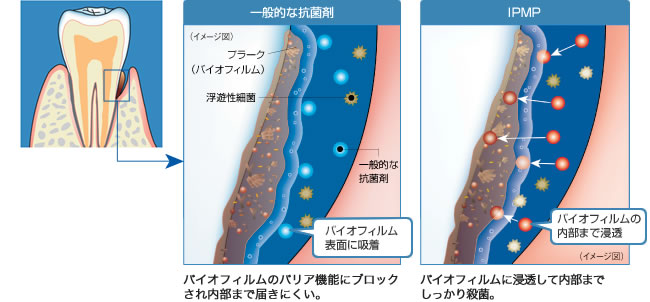 IPMPの浸透・殺菌効果