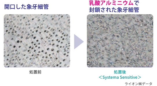 画像/長く働く乳酸アルミニウム